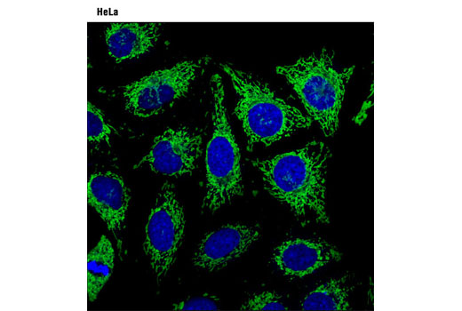 blue pseudocolor = draq503 #4084 (fluorescent dna dye).