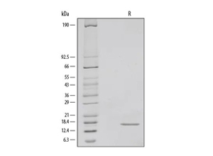 Recombinant Human IFN-gamma Protein