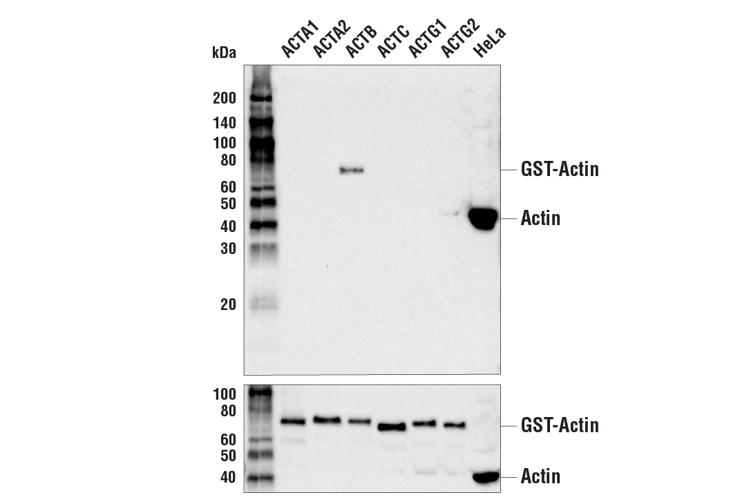 beta-Actin (13E5) Rabbit mAb