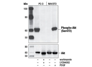Phospho-Akt (Ser473) (D9E) XP® Rabbit mAb