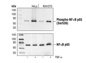 Phospho-NF-kappaB p65 (Ser536) (93H1) Rabbit mAb