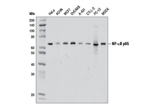 NF-kappaB p65 (D14E12) XP ®  Rabbit mAb