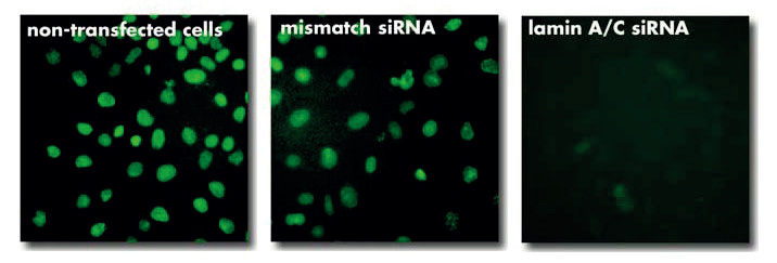 in vivo-jetRNA	活体mRNA转染试剂