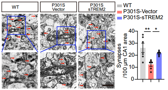 文献解析 | sTREM2有望改善AD患者的tau磷酸化和认知障碍