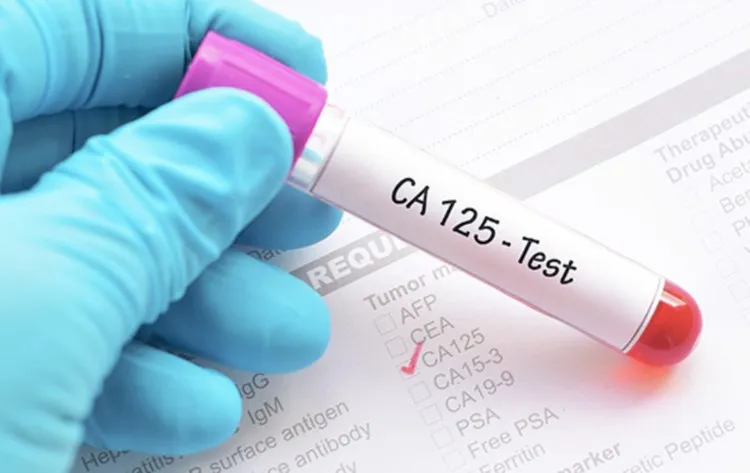 CA125:卵巢癌诊断的“双刃剑”与新希望