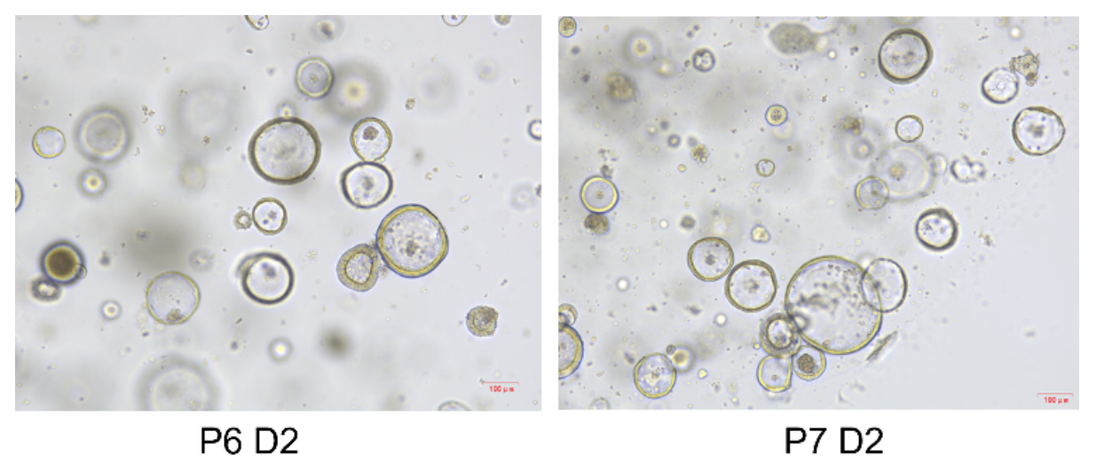 小鼠结肠类器官与细胞因子:构建体外微结肠的分子蓝图