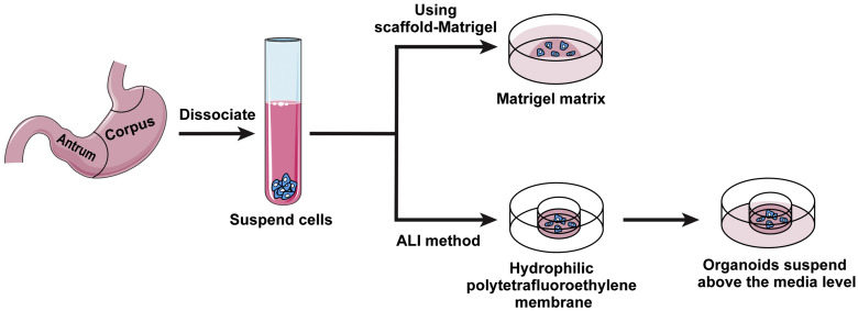 MOG(1-125)蛋白：解密视神经脊髓炎谱系疾病的关键生物标志物