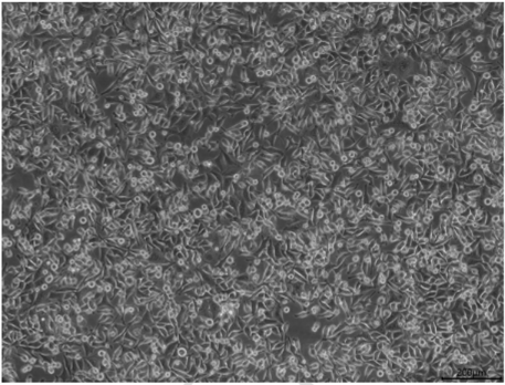 MGC-803、SNU-16、MKN-45、KATOIII胃癌细胞系培养合集来袭！