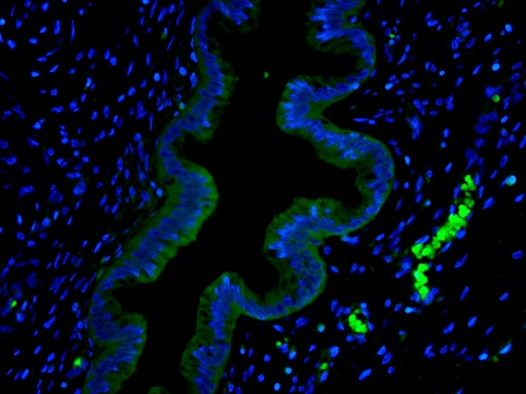 即用型组织封闭液：提升免疫染色信噪比的关键