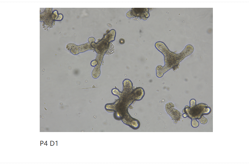 VEGF 120蛋白：血管生成的"可扩散信号导航员"