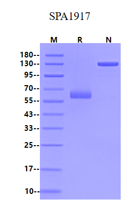 BTN1A1 Fc嵌合蛋白的结构特性与应用研究进展