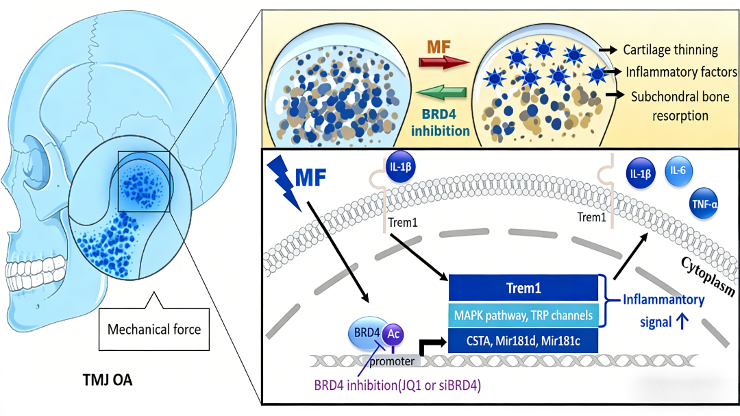 BRD4信号通路在应力诱导骨关节炎中的作用机制与靶向降解治疗策略