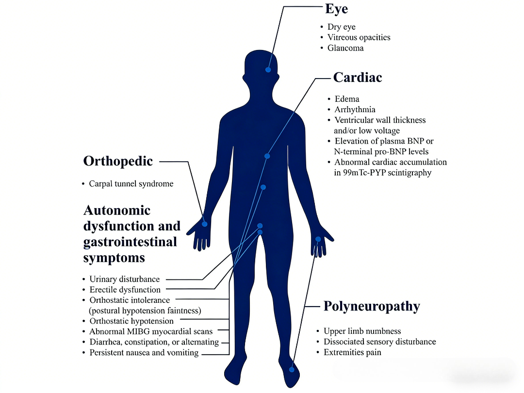 转甲状腺素蛋白相关家族性淀粉样多发性神经病的诊断策略