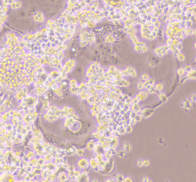 小鼠Raw264.7与BMMs破骨分化:原理与应用指南