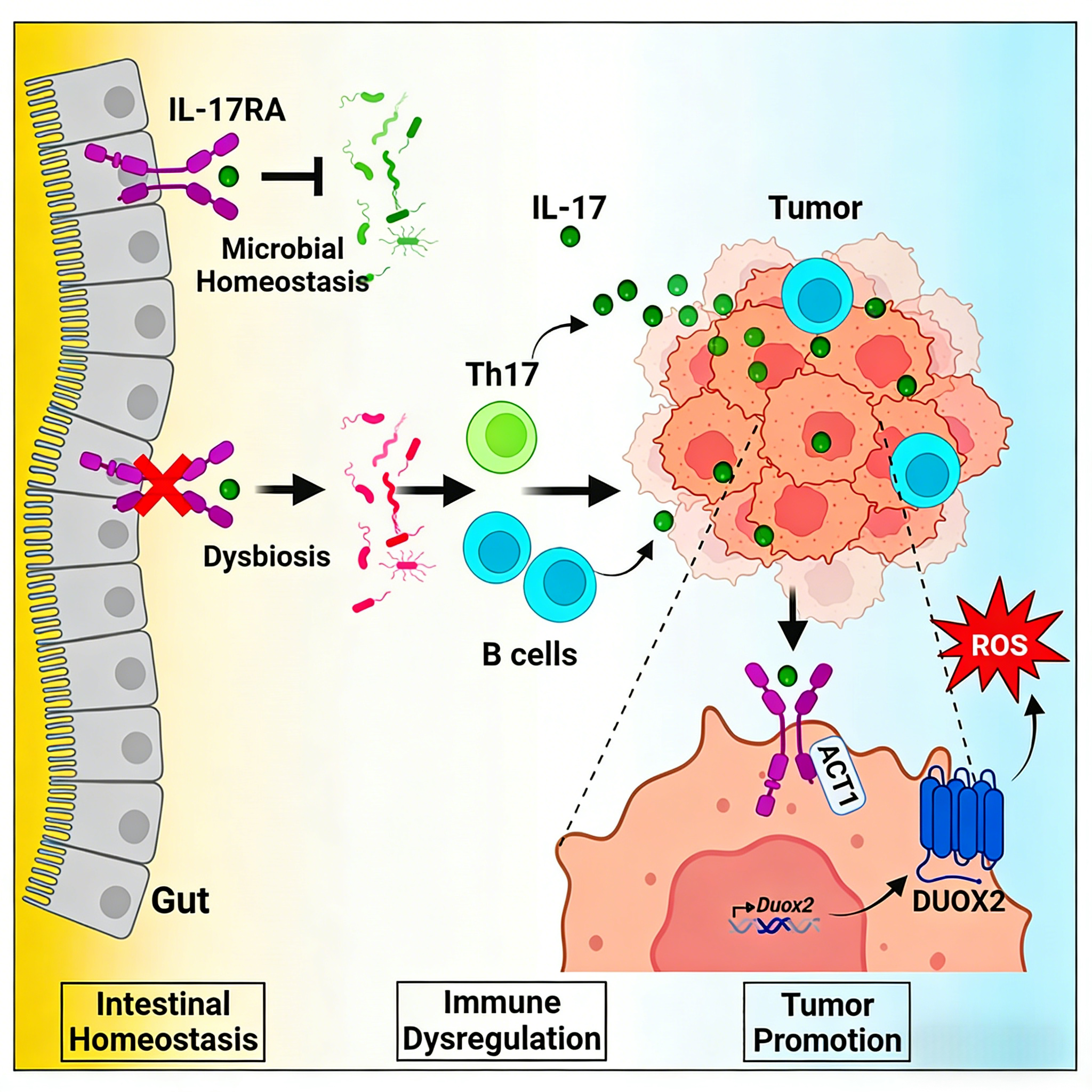肠道上皮IL-17RA信号通过调控菌群及免疫平衡影响远端肿瘤进展的机制研究