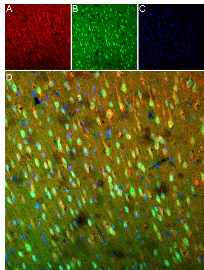 α- 布加罗毒素：胆碱能受体研究与神经科学工具