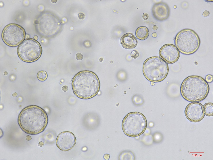 小鼠正常肺类器官细胞因子套装在肺类器官研究中的应用