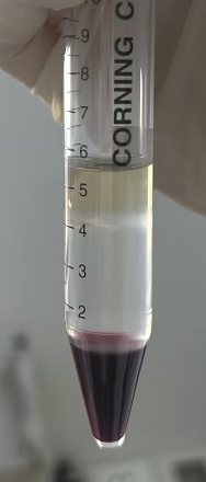 PBMC 分离攻略：如何获得高活率、高纯度的人外周血单个核细胞