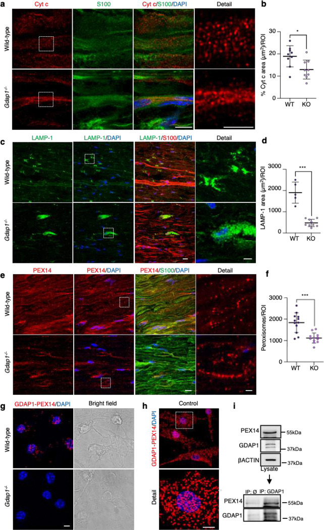 GDAP1 相关 CMT 新发现：氧化还原失衡是轴突病变核心诱因