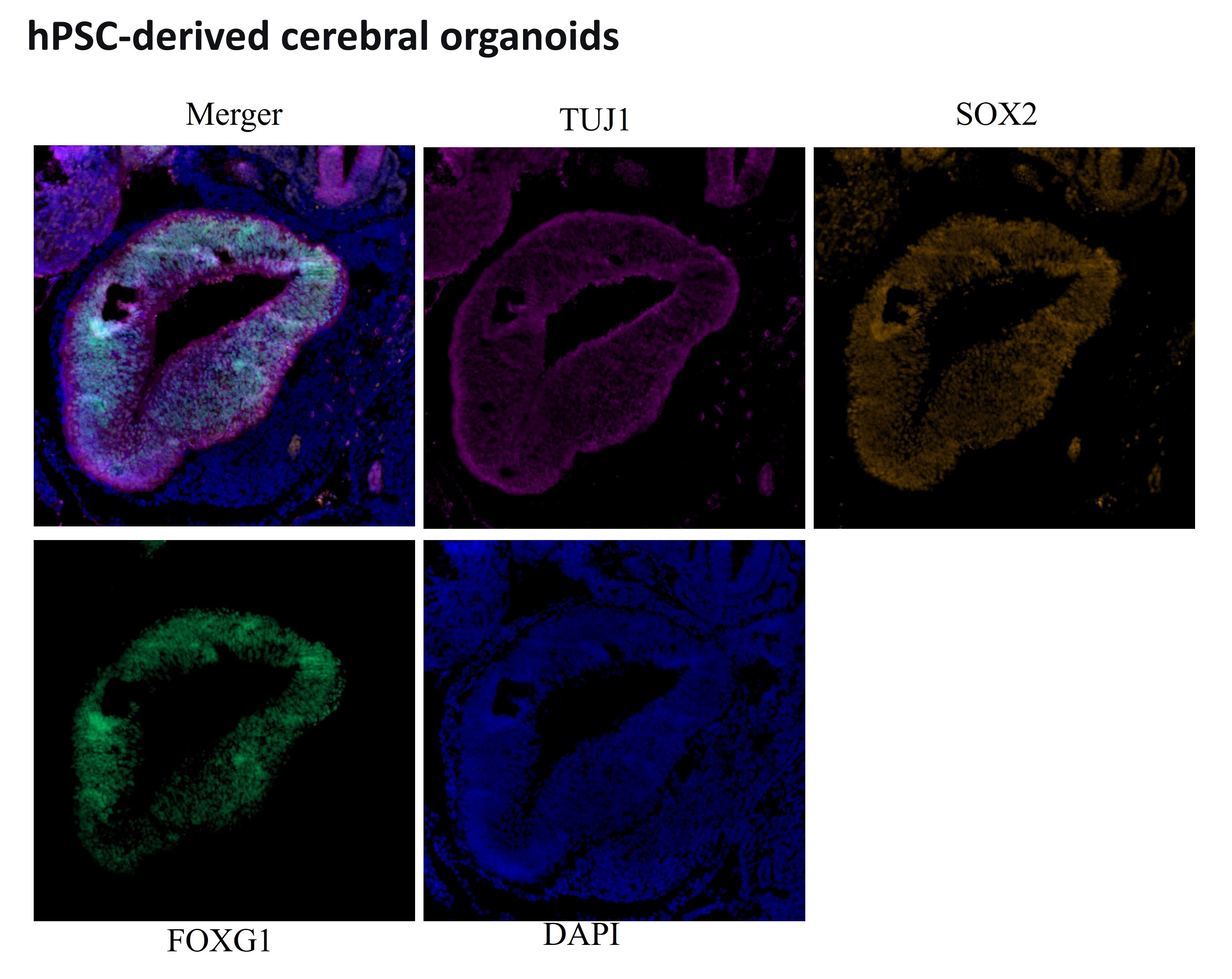 碱性成纤维细胞生长因子（154aa）的结构与功能研究进展