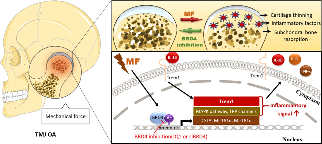 基于TR-FRET技术的BRD4靶向PROTAC降解剂在颞下颌关节骨关节炎中的研究