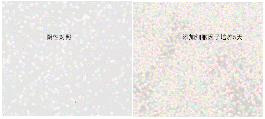 人 B 细胞极化细胞因子套装：高效诱导 B 细胞活化扩增的实验工具