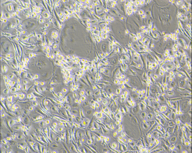 CD3E与CD3D靶点深度解析:分子机制、免疫缺陷病及TCE双抗的最新进展