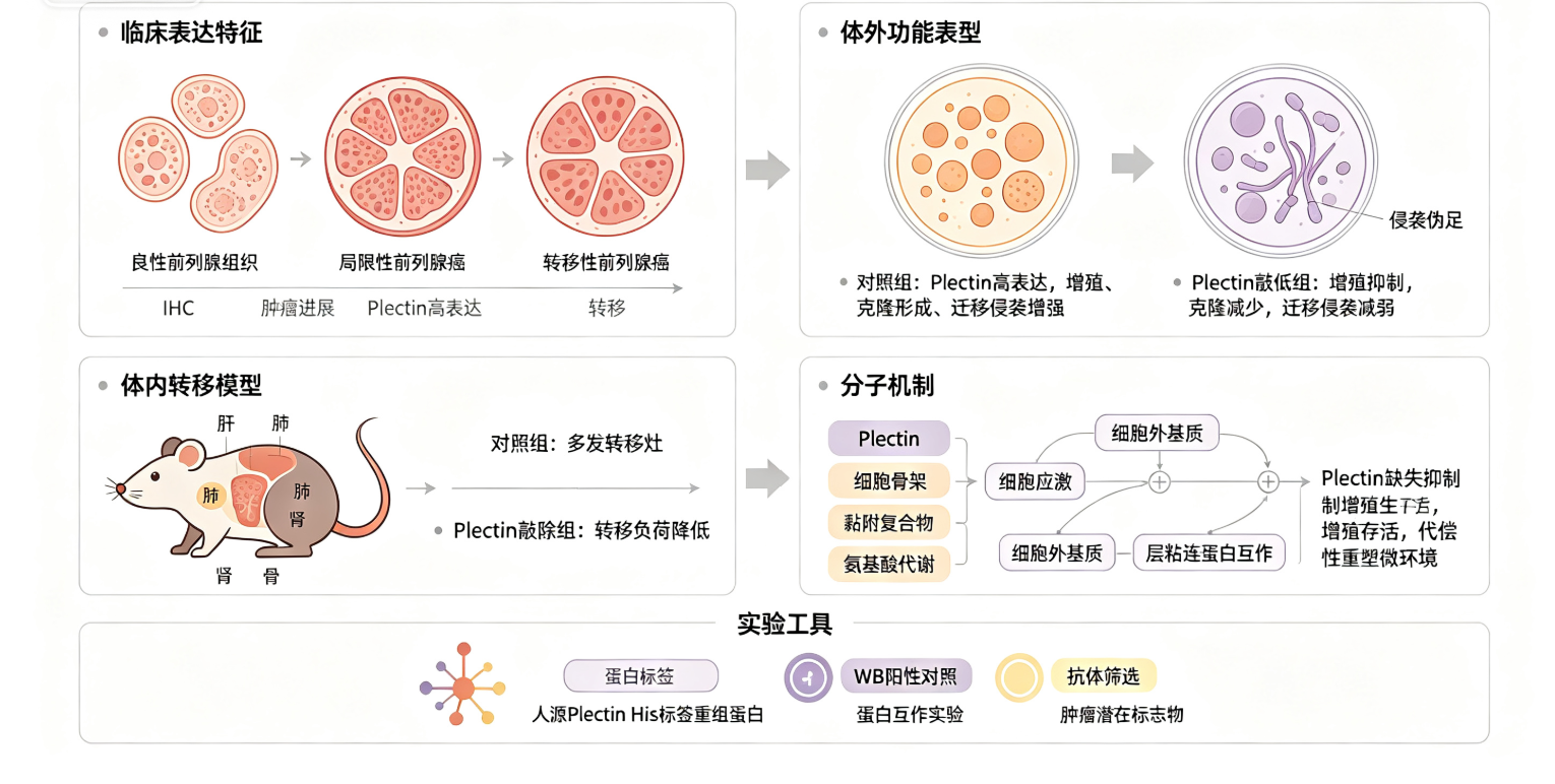人源网蛋白Plectin在前列腺癌生长与转移中的调控作用及其分子机制