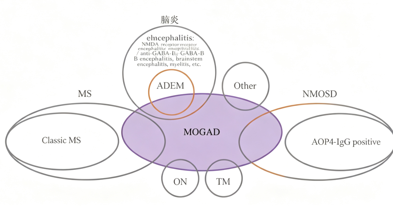 MOGAD的疾病特征、诊断策略与治疗原则