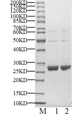 重组人Cyclin A2蛋白 怎么选？价格、厂家、规格与质量指标全解｜Cyclin A2 Protein, Human