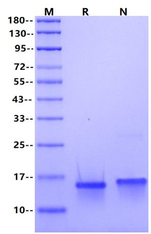 重组人MIG/CXCL9蛋白 怎么选?价格、厂家、规格与质量指标全解|MIG/CXCL9 Protein, Human